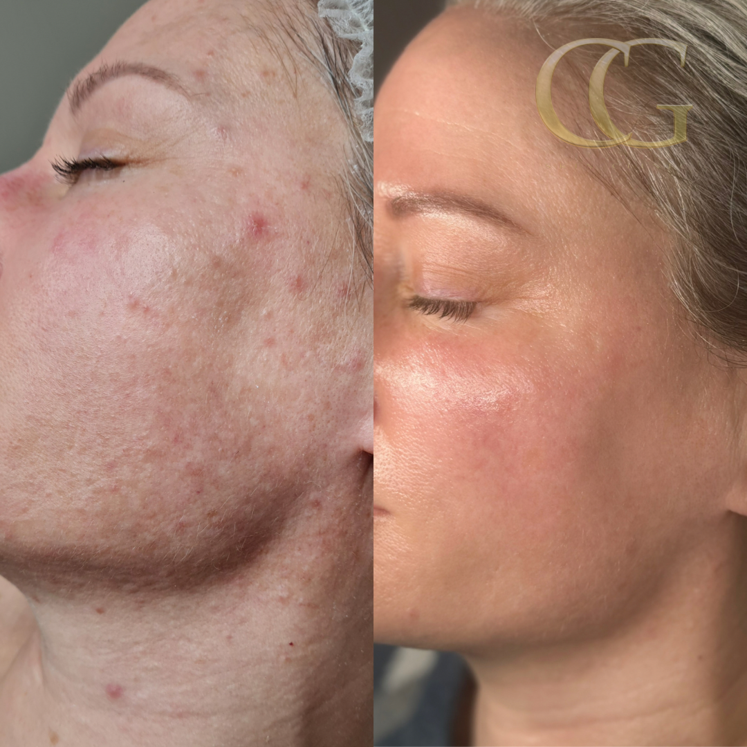 6 Week Transformation