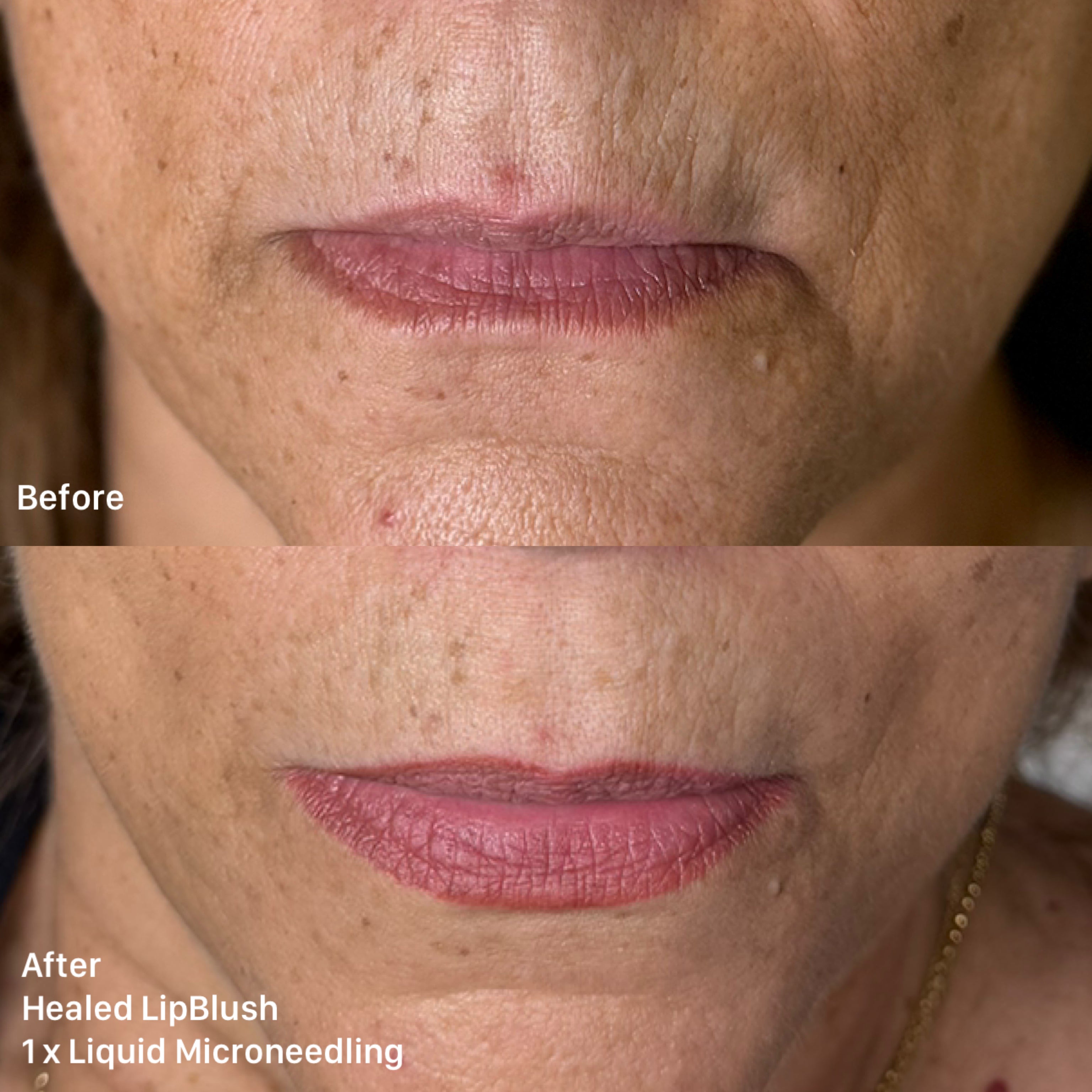 Bespoke Lips