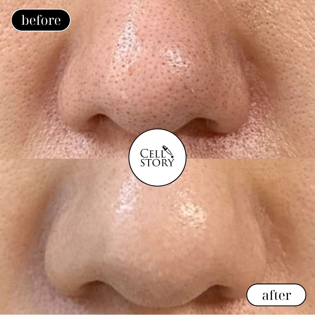 Cell Story Liquid Microneedling: Block of 2