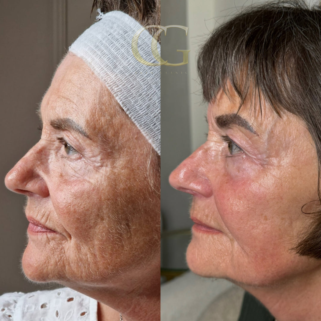 6 Week Transformation